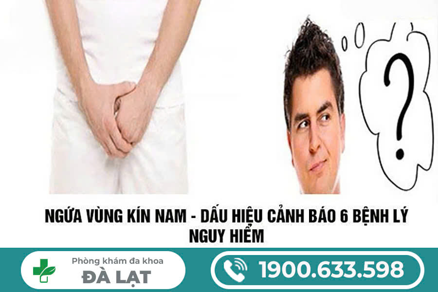 Hình ảnh minh họa